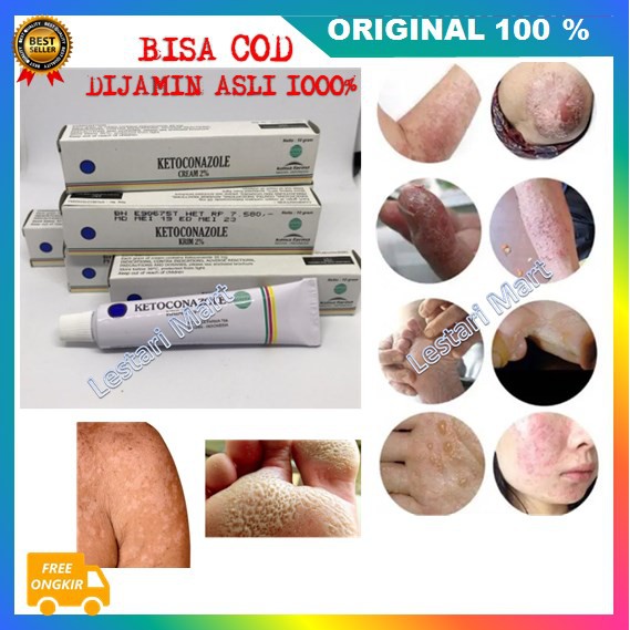 [BISA COD] Ketoconazole Salep Infeksi Jamur Panu Kurap Kadas Kutu Air Manjur Original