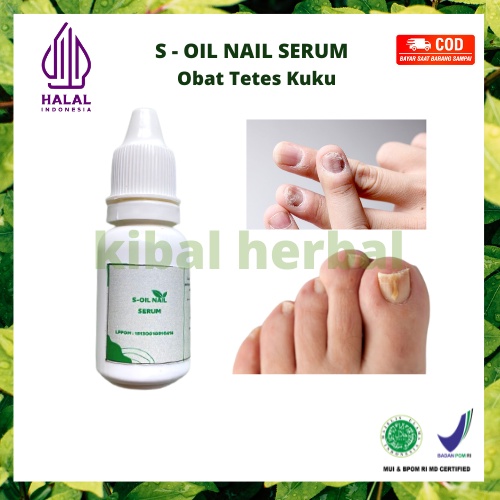 Cantengan: Mengatasi Gangguan Kuku yang Menyakitkan dengan Obat Herbal Alami