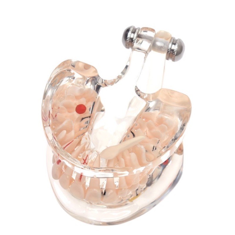 Dental Study Model Gigi Orthodontic Malocclusion PVC + Resin / Patung Gigi Phantom Bisa Di Lepas