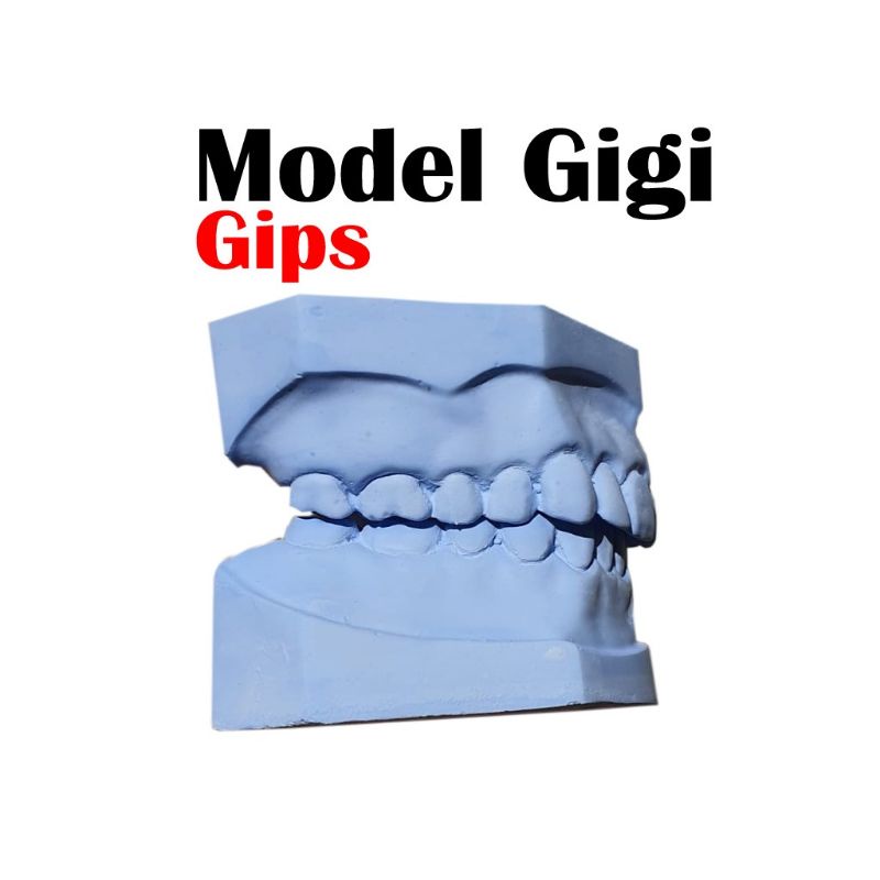 model gigi PATUNG GIGI GIPS / DENTAL STUDY