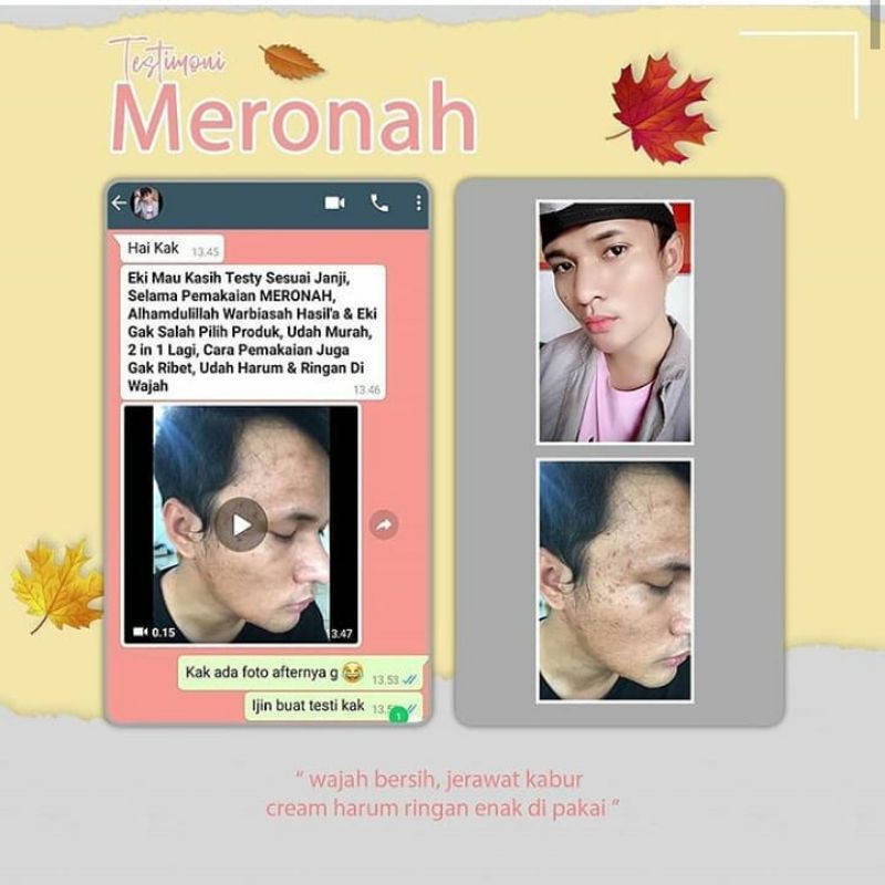 PAKET WAJAH JERAWAT/SENSITIVE/FLEK KUSAM  MERONAH(JERAWAT,BRUNTUS,FLEK)