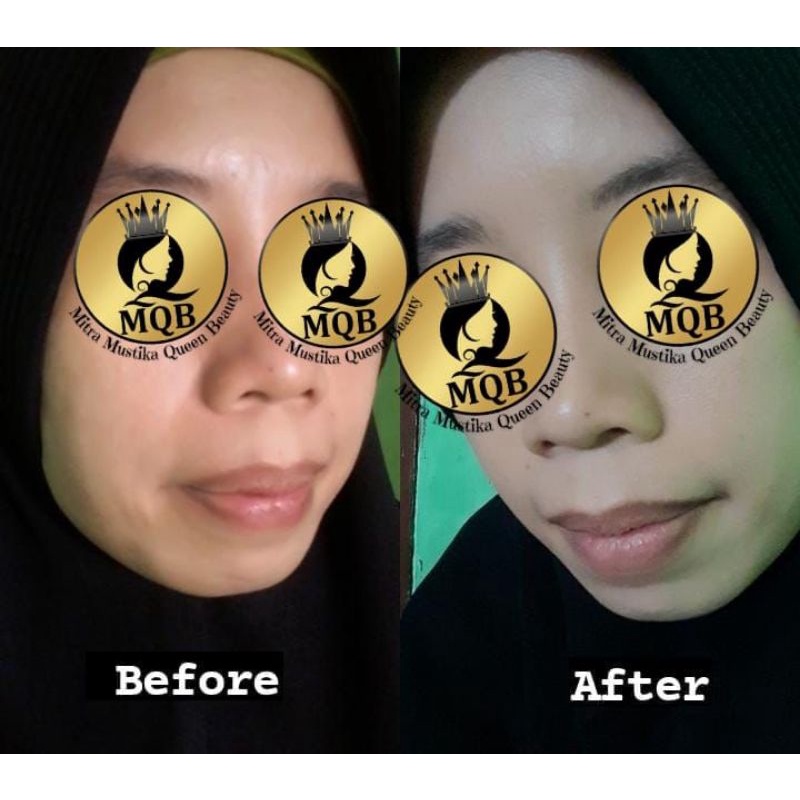 PAKET MQBeauty Brightening Series [free red jelly + cream jerawat] Skincare BPOM - MQ Beauty Krim Perawatan Wajah [ORIGINAL] 1 [ BAYAR DITEMPAT] [ASLI]-7