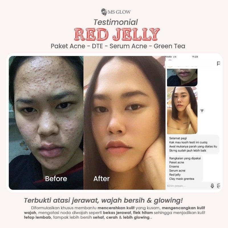 MS GLOW Red jelly Sleeping Mask Moisturizer 15gr