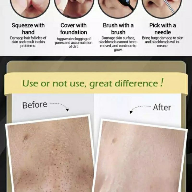 LANBENA Penghilang Komedo Hidung Hitam Masker Wajah Paling Ampuh