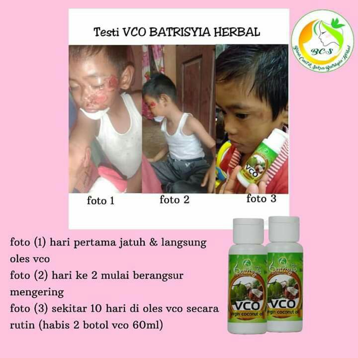 VCO Batrisyia Herbal 250 ml, Virgin Coconut Oil