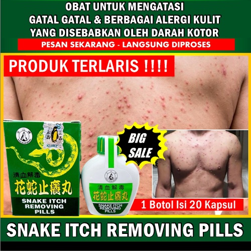 

BIG SALE Obat gatal snake itch removing pills cina original obat alergi gatal herbal pembersih darah kotor