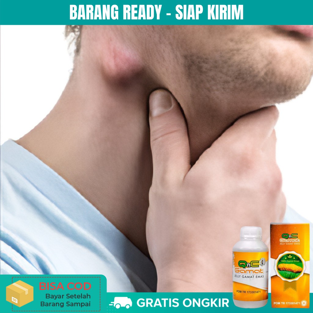 Obat TBC Kelenjar, Benjolan di Leher, Kelenjar Getah Bening Bengkak