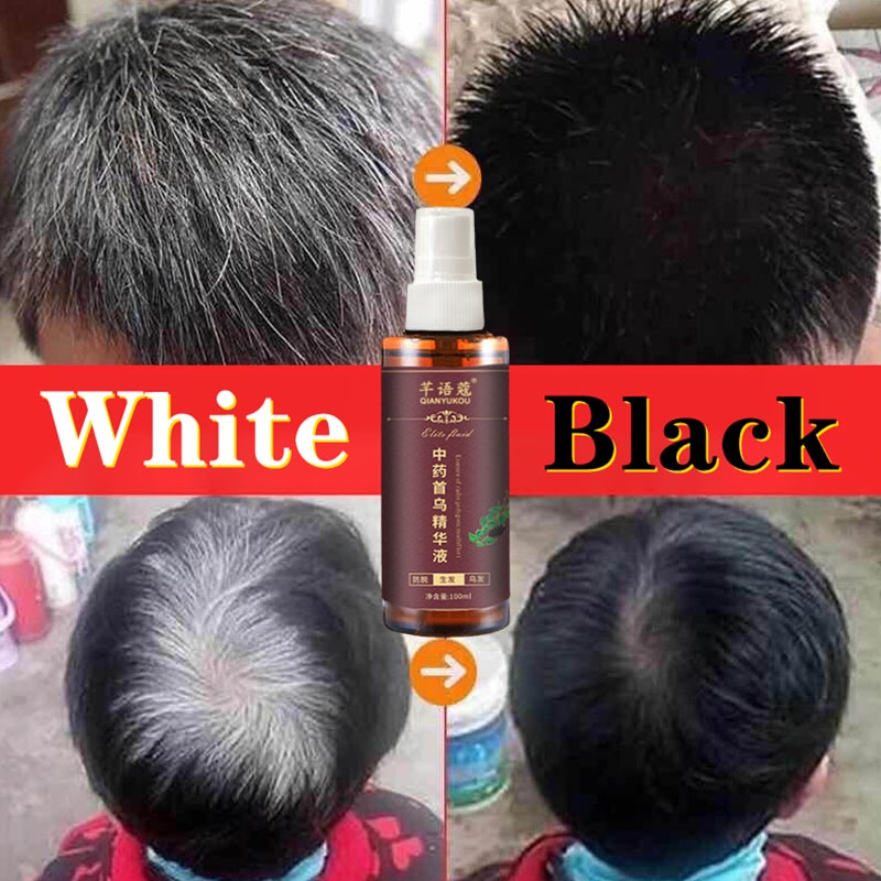 【COD】100ml Serum Rambut Anti Rambut Rontok Esensi Polygonum Esensi Herbal Tionghoa Serum Rambut Hitam Menghitamkan Rambut Putih Mempromosikan Pertumbuhan Rambut