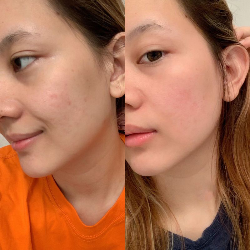 [ COD ] SCARLETT WHITENING FACE CARE / PERAWATAN WAJAH-6