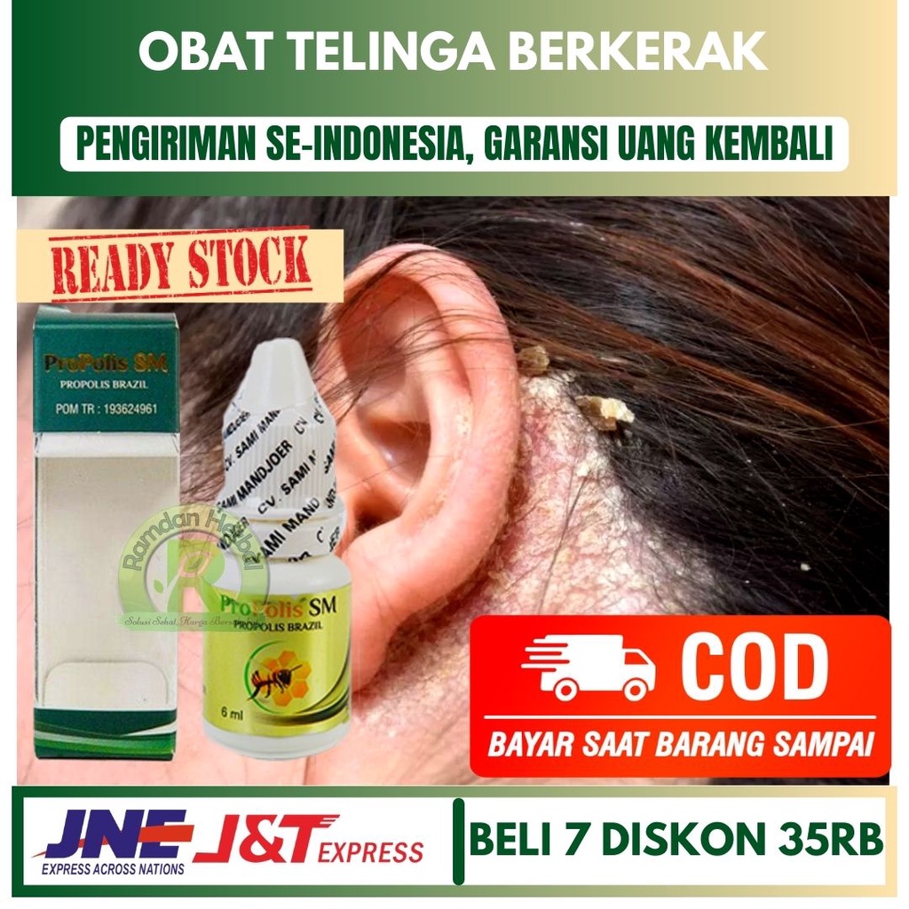 Obat Telinga Berkerak Berair Bau Gatal Nyeri Daun Telinga Berketombe Berkerak Propolis Sm Bpom Shopee Indonesia