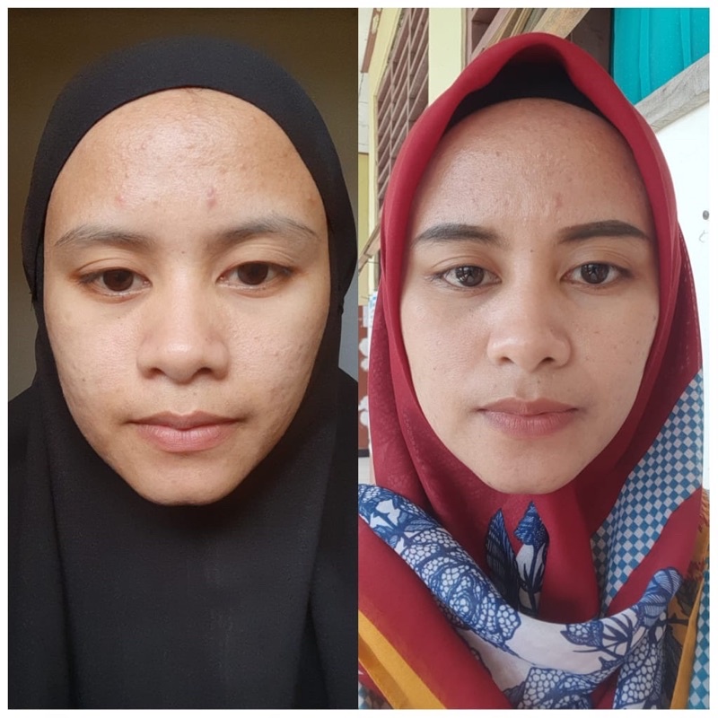 Serum Glowing Bunga Sakura Hyde Beauty Skincare