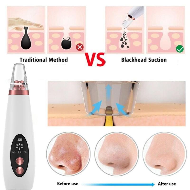 Facial Pore Cleaner Komedo Remover Vacuum Suction Cleaner Pori Jerawat Komedo