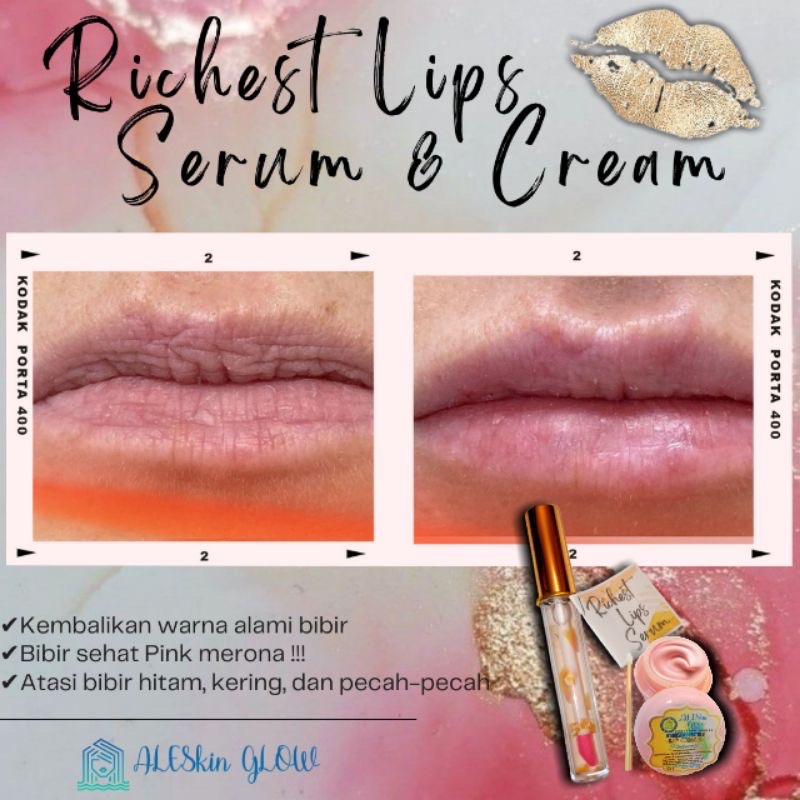 Lips Serum Cream Pemerah Bibir Pelembab Pencerah Bibir Hitam Lip Balm Lips Care Richest by Aleskin Glow 1