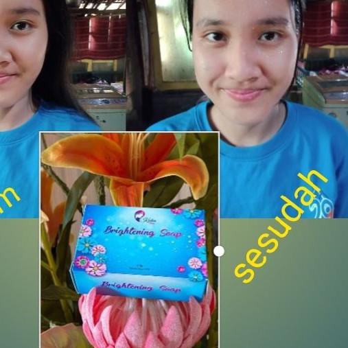 ◄ Sabun Kedas Beauty Original BPOM Kedas Beauty Sepaket Gold Jelly Kedas Beauty Paket Kedas Beauty ✽