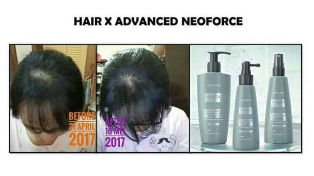 HAIR X NEOFORCE SET / PERAWATAN RAMBUT RONTOK Import swedia