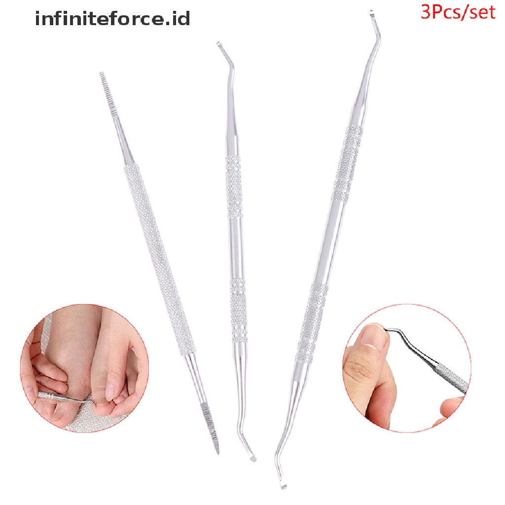 Infiniteforce.id 3pcs / set Alat Kikir Kuku Kaki Ingrown Untuk Manicure / Pedicure