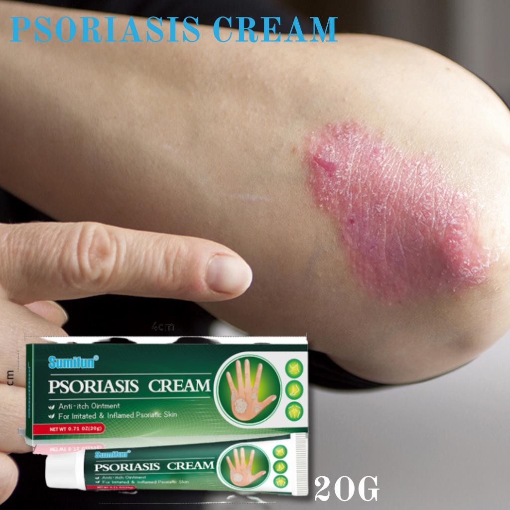 salep psoriasis,cream gatal psoriasis , salep gatal infeksi jamur kulit, cream untuk menyembuhkan ek