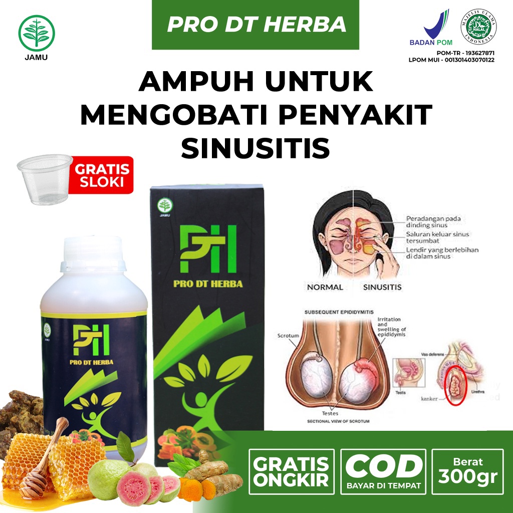 Obat Sinusitis Paling Ampuh, Polip Hidung Herbal Menahun Herbal, Hidung Tersumbat, Pilek Menahun Her