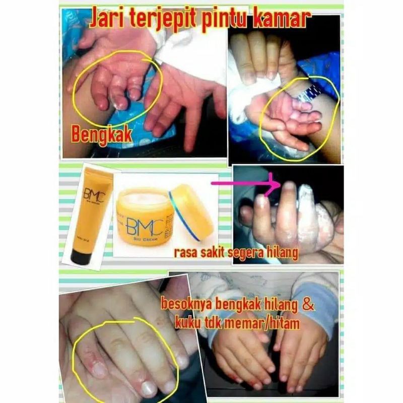 Bmc Bio Multriple Cream Multifungsi Nano Teknology P3k Ajaib 60 Gr Shopee Indonesia