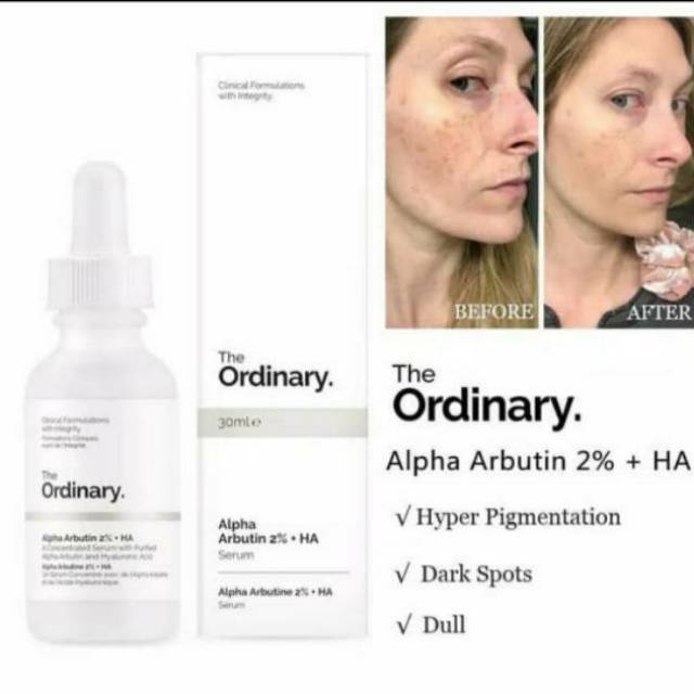 The ordinary alpha arbutin 2%+HA original canada