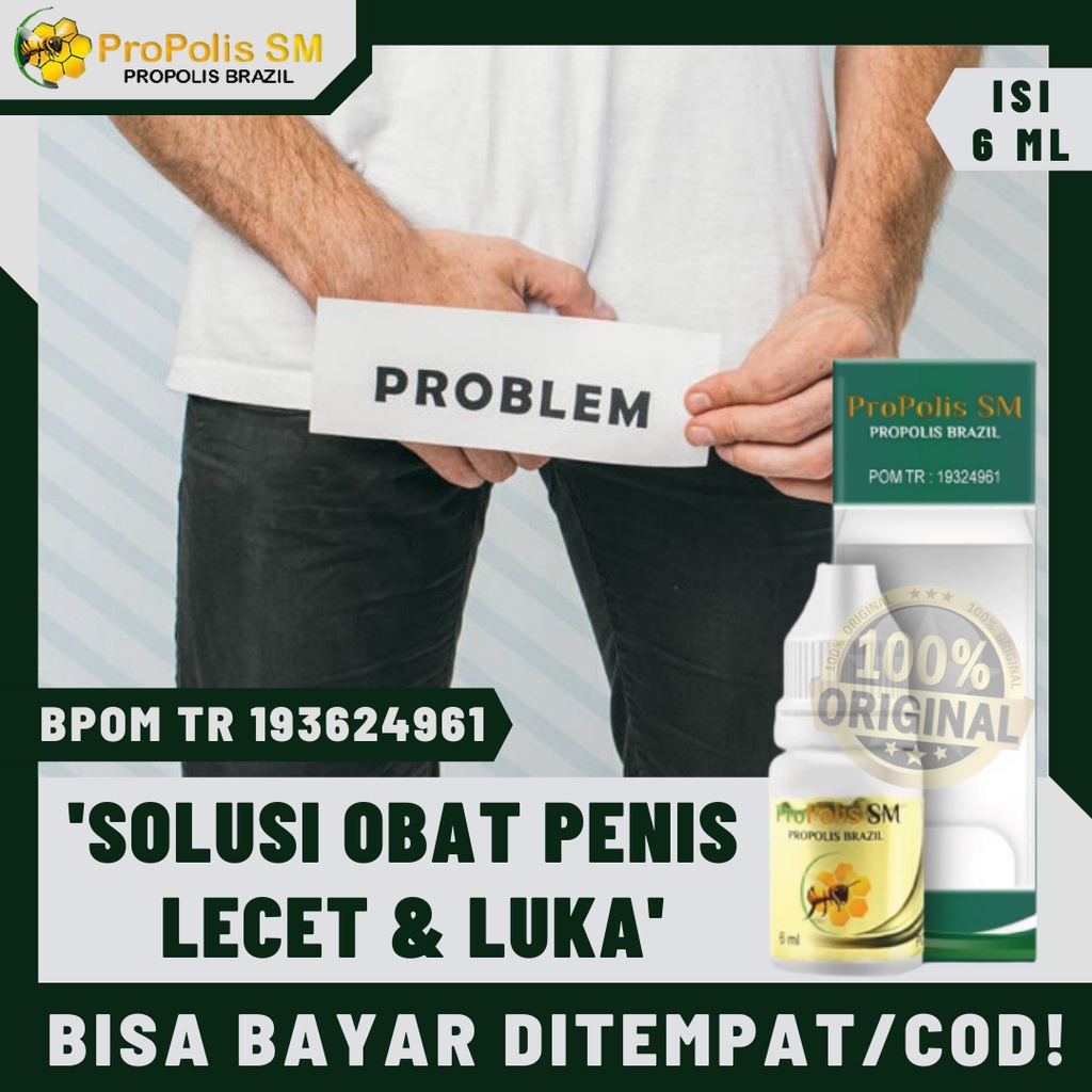 Penis Lecet Perih Gatal Ruam Merah Mengelupas Propolis Brazil SM Alami Obat Oles Membantu Meredakan 