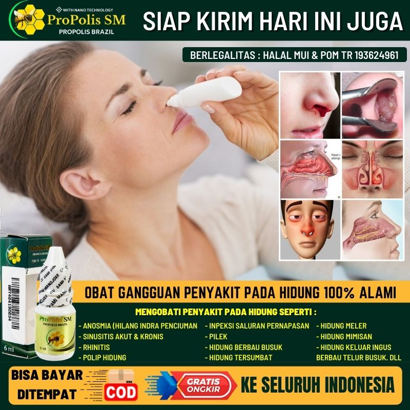 Obat Penghilang Ingus Bau Busuk 100% Alami, Obat Sinusitis Herbal Untuk Anak & Dewasa, Obat Nyeri Hi