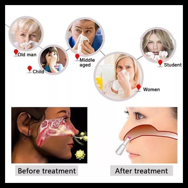 BIONASE ALAT TERAPI SINUS SINUSITIS HIDUNG PILEK BEST SELLER