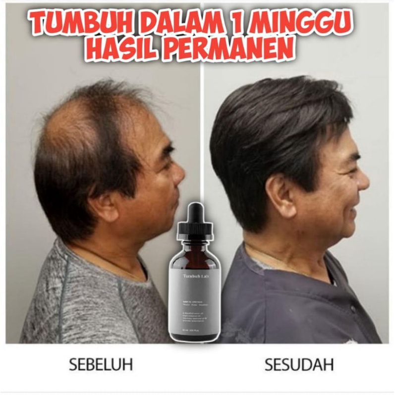 TUMBUH LAB *PAKET BRONZE*