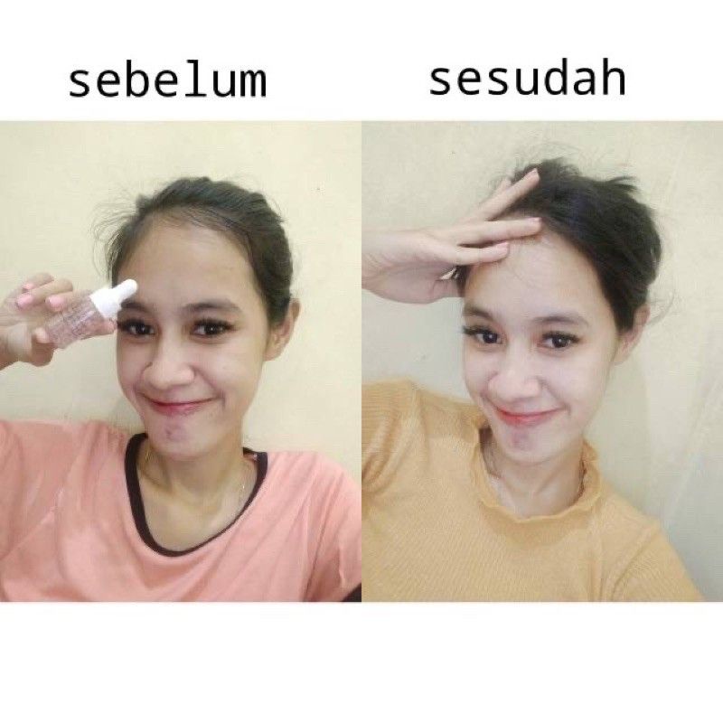 Serum Glowing Whitening Pemutih Wajah 10ml