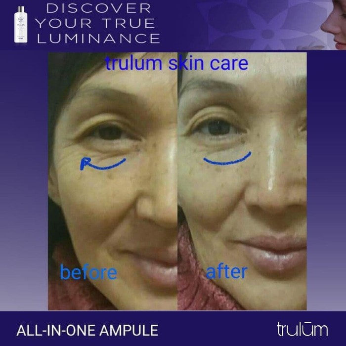 Serum Krim Obat Cream Pemutih Wajah Terbaik BPOM Dengan Aman Dan Cepat