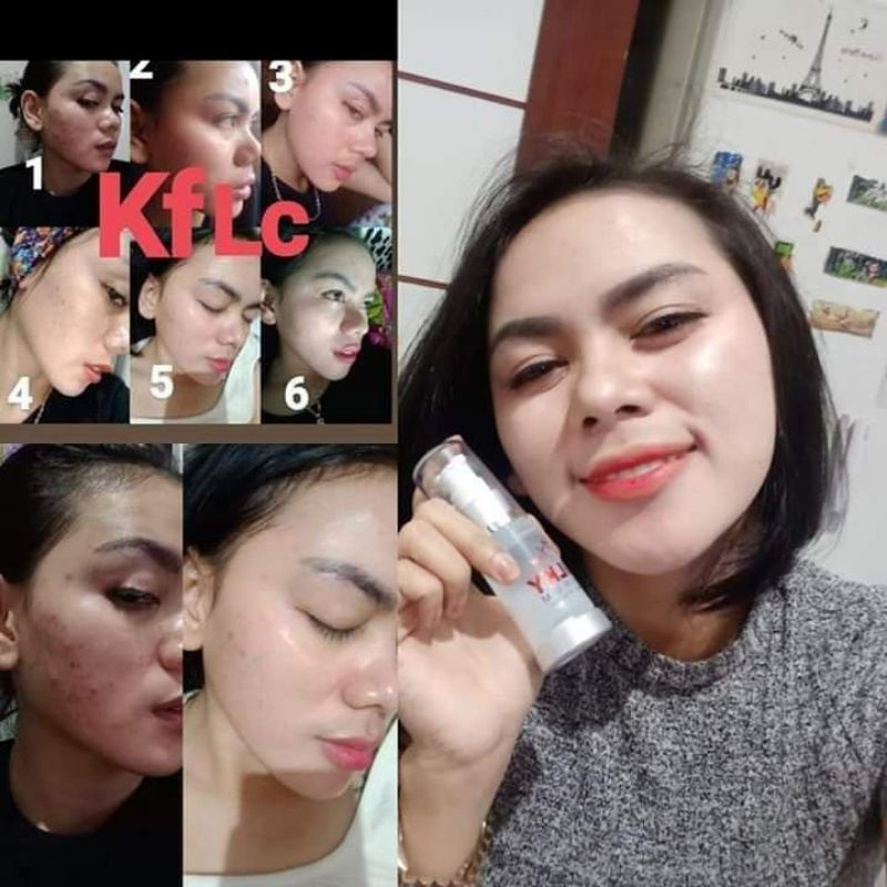 silky serum untuk kulit kering dan jerawat perawatan untuk kulit wajah yg sensitif