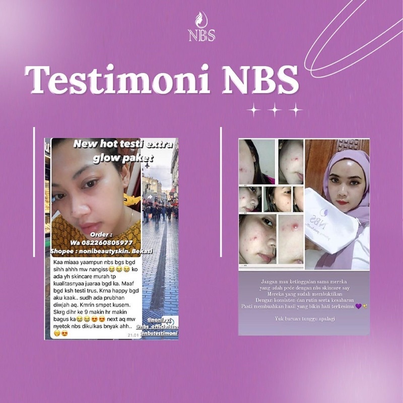 N B S EXTRA GLOW N B S ULTIMATE PEMUTIH WAJAH PENGHILANG FLEK JERAWAT ORIGINAL NONI BEAUTY SKINCARE