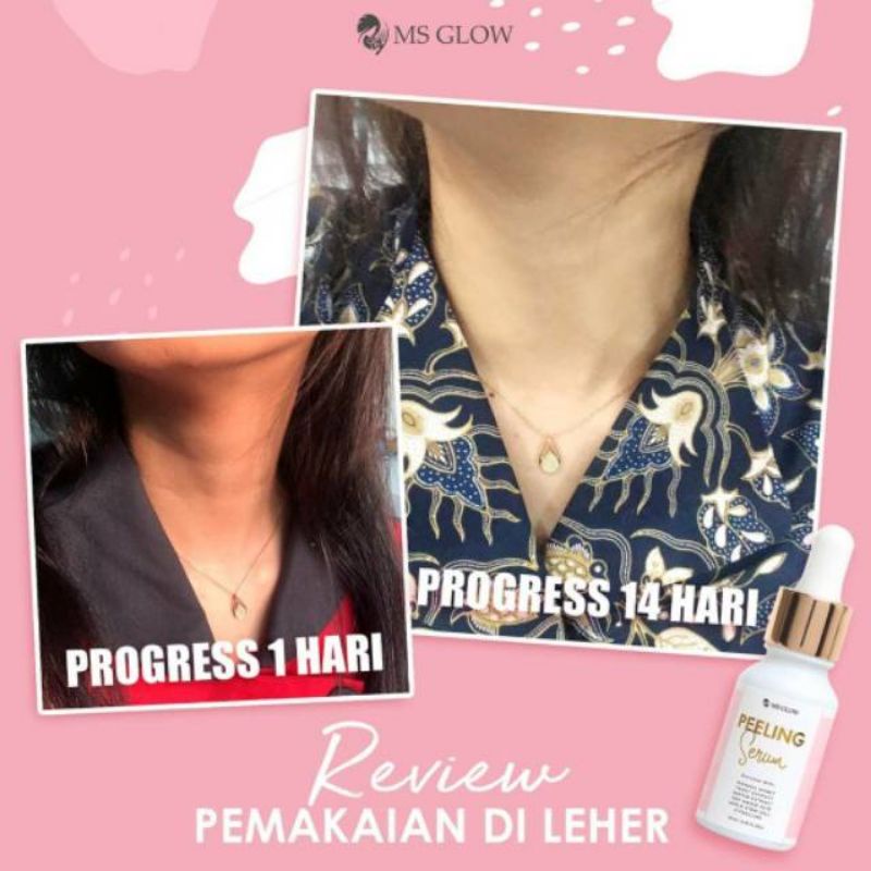 SERUM PEELING ORIGINAL MS GLOW (SUSAH BER BARCODE)