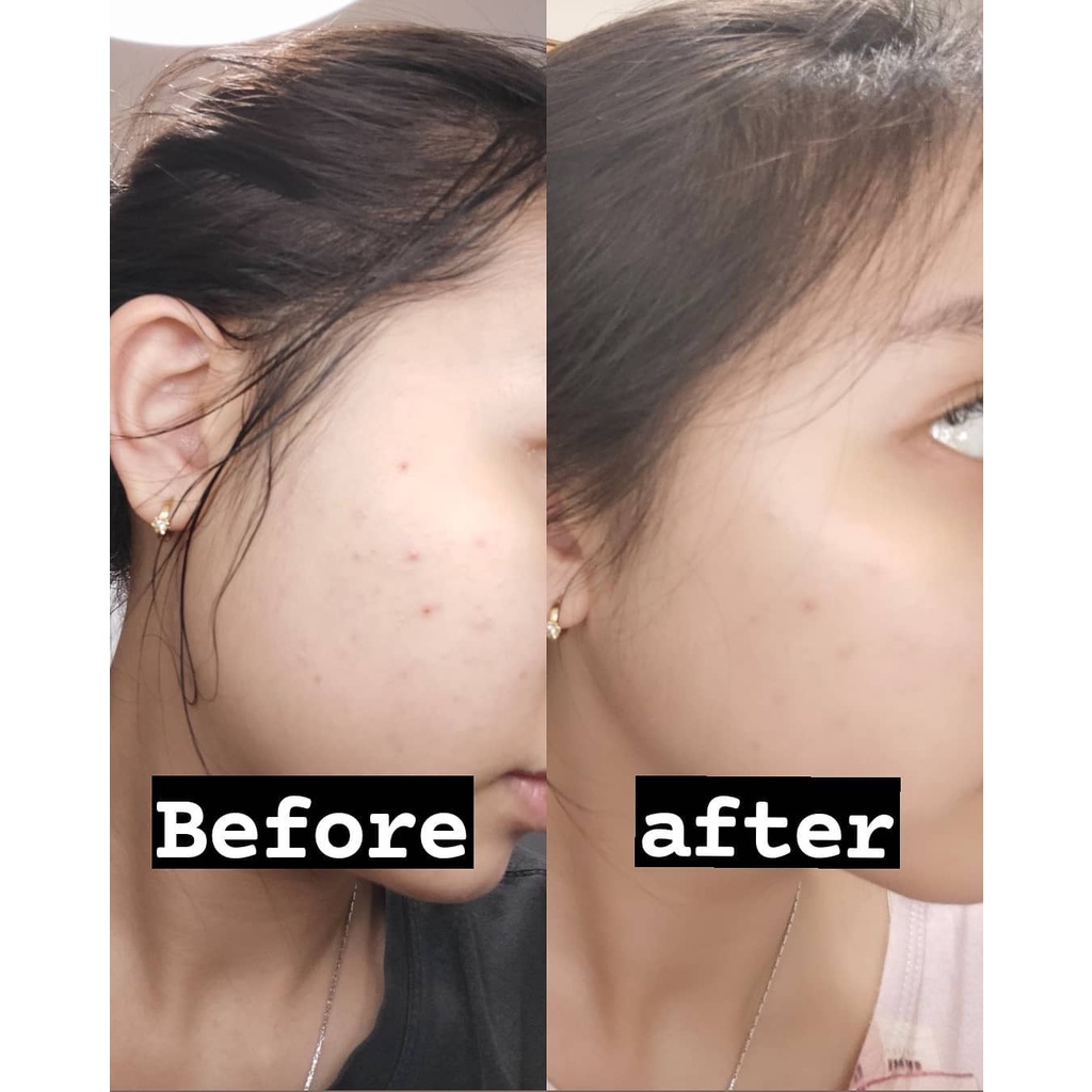 Pratista Skin Glow Serum Wajah Mencerahkan &amp; Membuat Glowing