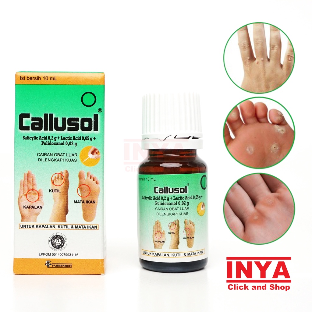 CALLUSOL 10ml - Obat Kulit - Kapalan - Kutil - Mata Ikan - Calluses - Wart