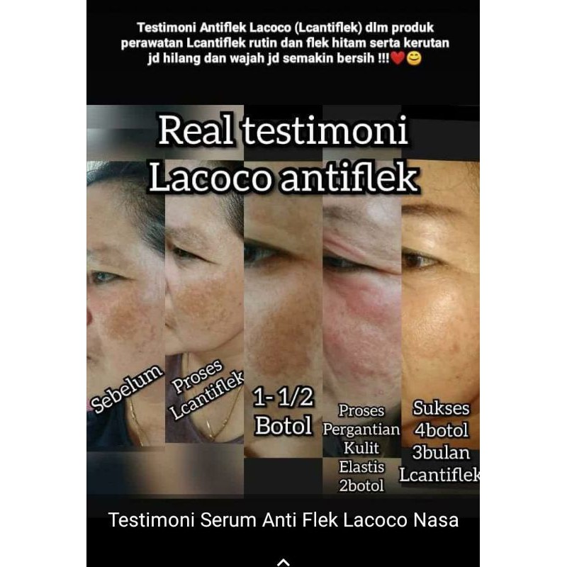 Lacoco Dark Spot Essence Serum flek hitam Nasa