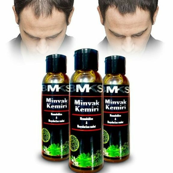 MINYAK KEMIRI BMKS ORIGINAL 100% ASLI PENYUBUR RAMBUT BOTAK DAN RONTOK