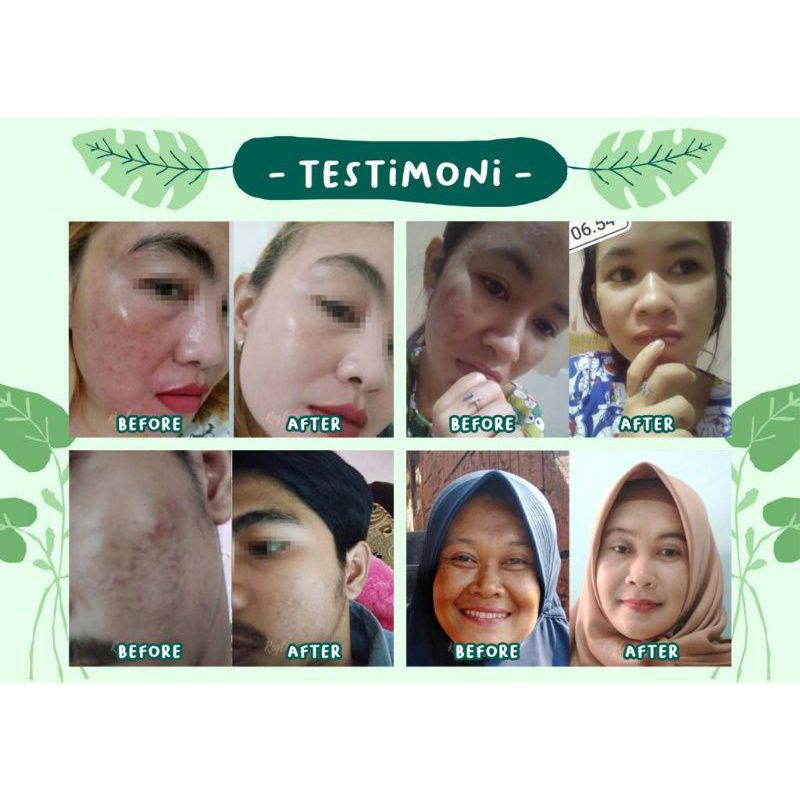 (FREE GIFT EMAS) - REGLOW SKINCARE GLOWING BY DR SHINDY PUTRI - ORIGINAL 100%