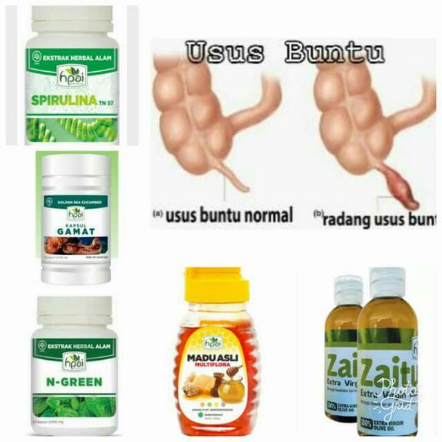 Obat Radang Usus Buntu Paket Herbal Hpai Shopee Indonesia