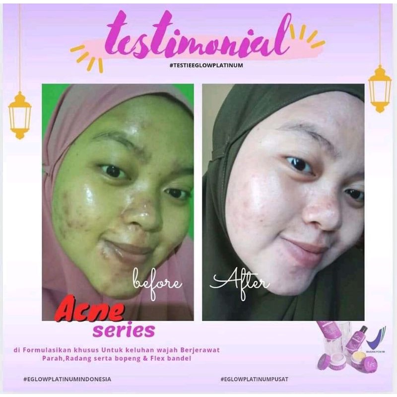 EGlow Platinum Skincare