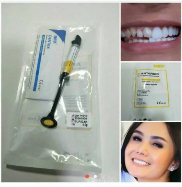 Komposit Dentex Anterior Composite Veneer Extra White DX Esthetic XW atau EXW atau EW Enamel Shade