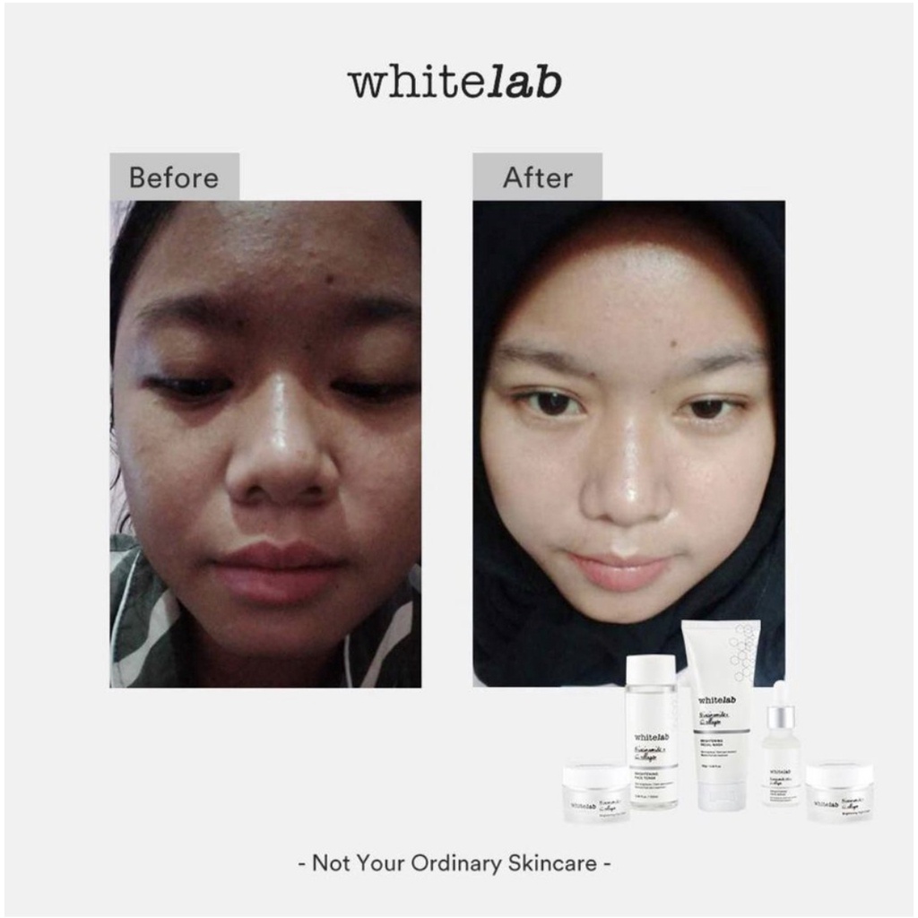 Whitelab Brightening Paket Wajah &amp; Serum | Facial Wash + Toner + Day Cream + Nite Cream + Brightening Serum