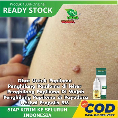 Obat Untuk Papiloma - Penghilang Papiloma di leher - Penghilang Papiloma Di Wajah - Penghilang Papil