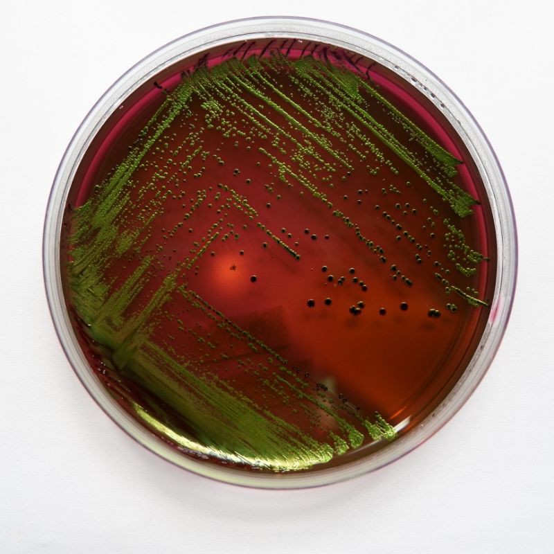 EMBA (Eosin Methylene Blue Agar) merk Oxoid / Gram