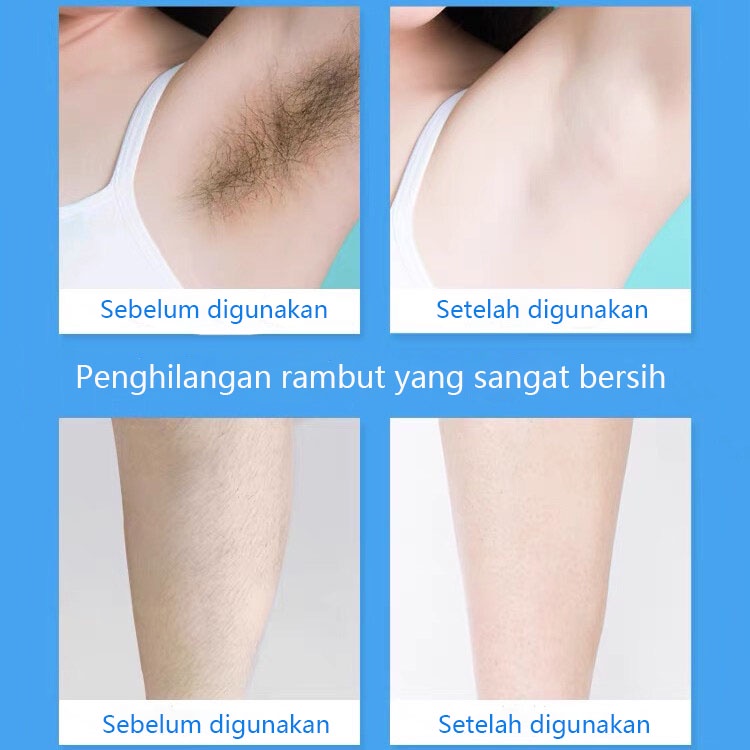 krim penghilang bulu penghilang bulu permanen penghilang bulu ketiak 150g Unisex Spray Penghilang Bulu Halus Nyaman Menghilangkan Bulu Dengan Lembut