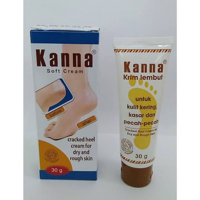 ORIGINAL KANNA SOFT CREAM 30 GRAM / FOOT LOTION KRIM KAKI KULIT 30 GR