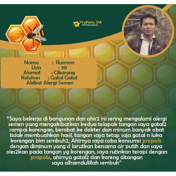 Obat Gatal Gatal Oles, Kulit Gatal Kering, Gatal Beruntusan Bruntusan, Obat Alergi Kulit, Exim, Eksim Kering, Obat Cenang Bernanah, Kulit Cenang, Scabies Manusia, Obat Gatel Gatel, Gatel Scabies Manusia, Salep Budug Cenang Propolis SM Terlaris 100% Ori-6