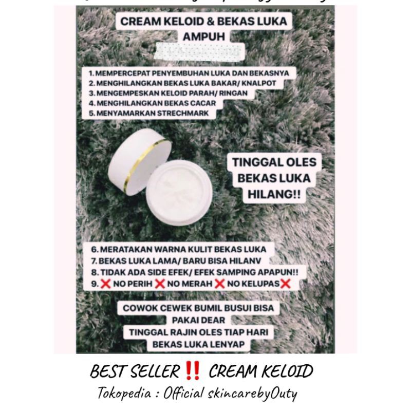 Cream Keloid Royyal Beauty