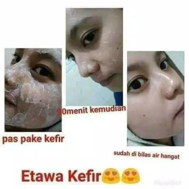 Masker Kefir SR12 /BELI MASKER GRATIS KUAS