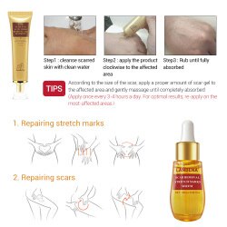 LANBENA SCAR REMOVAL STRETCH MARKS SERUM Penghilang Bekas Luka Stretch Mark